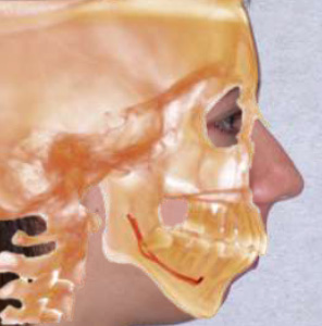 CBCT & Airway-centered Orthodontic Treatment Planning