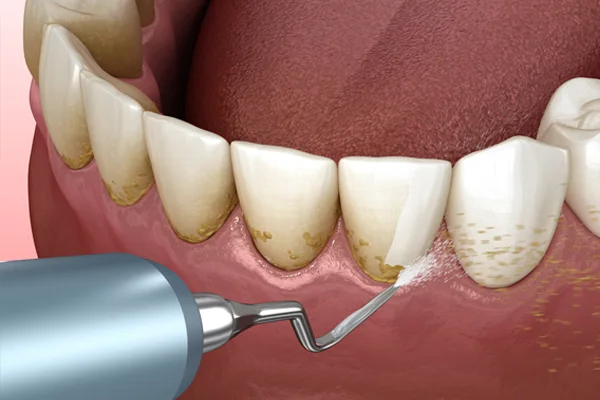 Periodontics